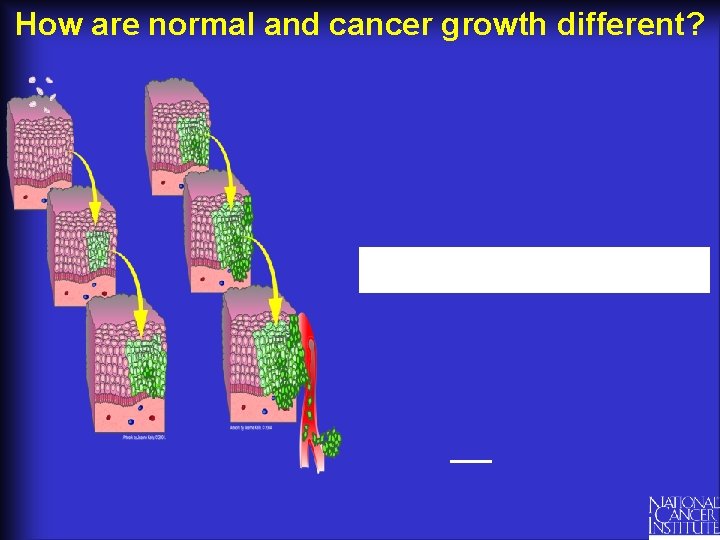 How are normal and cancer growth different? 