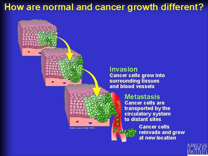 How are normal and cancer growth different? Invasion Cancer cells grow into surrounding tissues