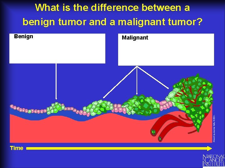 What is the difference between a benign tumor and a malignant tumor? Benign Time