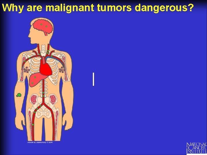 Why are malignant tumors dangerous? 