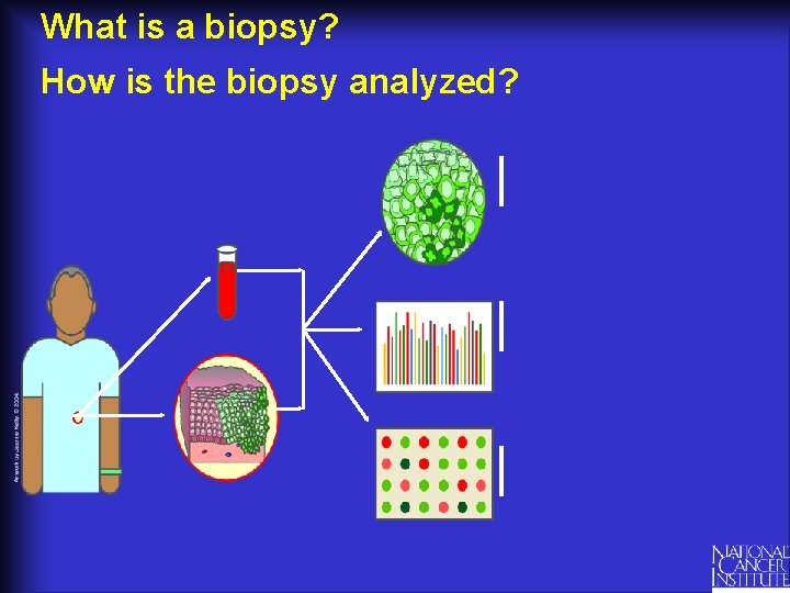 What is a biopsy? How is the biopsy analyzed? 