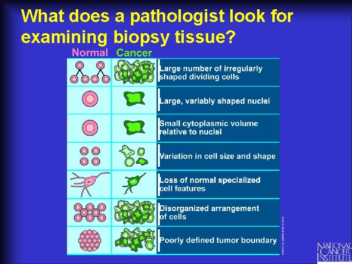 What does a pathologist look for examining biopsy tissue? 