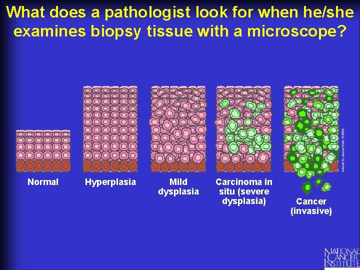 What does a pathologist look for when he/she examines biopsy tissue with a microscope?