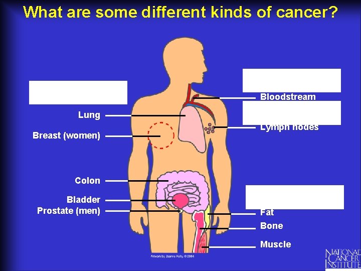 What are some different kinds of cancer? Bloodstream Lung Breast (women) Lymph nodes Colon