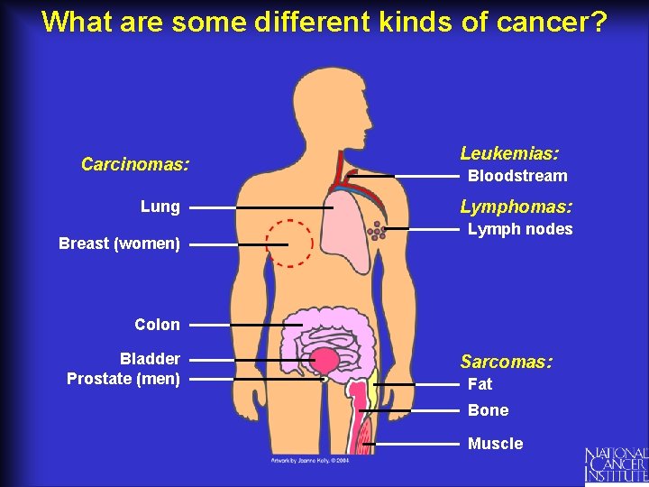 What are some different kinds of cancer? Carcinomas: Lung Breast (women) Leukemias: Bloodstream Lymphomas: