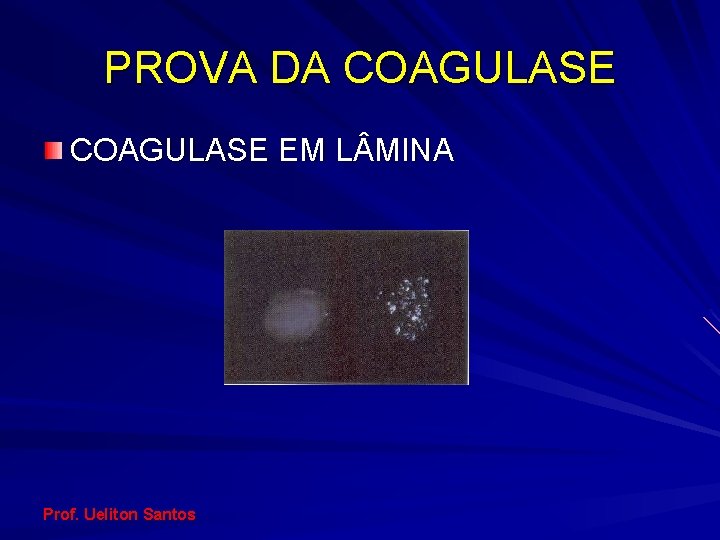 PROVA DA COAGULASE EM L MINA Prof. Ueliton Santos 