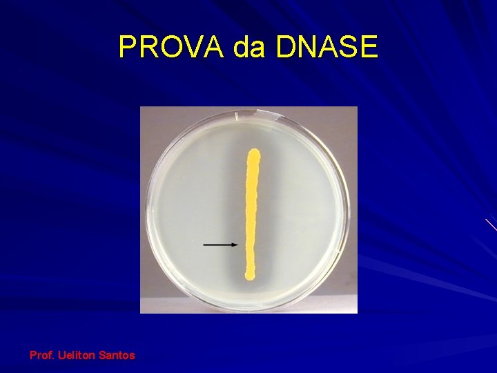 PROVA da DNASE Prof. Ueliton Santos 