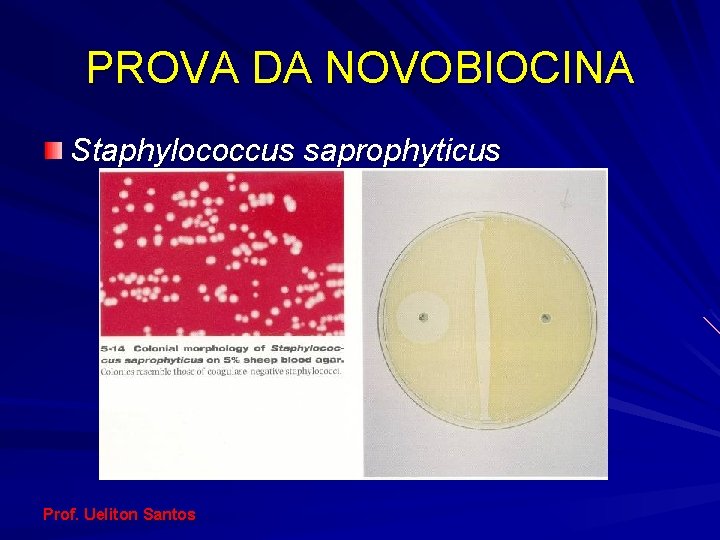 PROVA DA NOVOBIOCINA Staphylococcus saprophyticus Prof. Ueliton Santos 