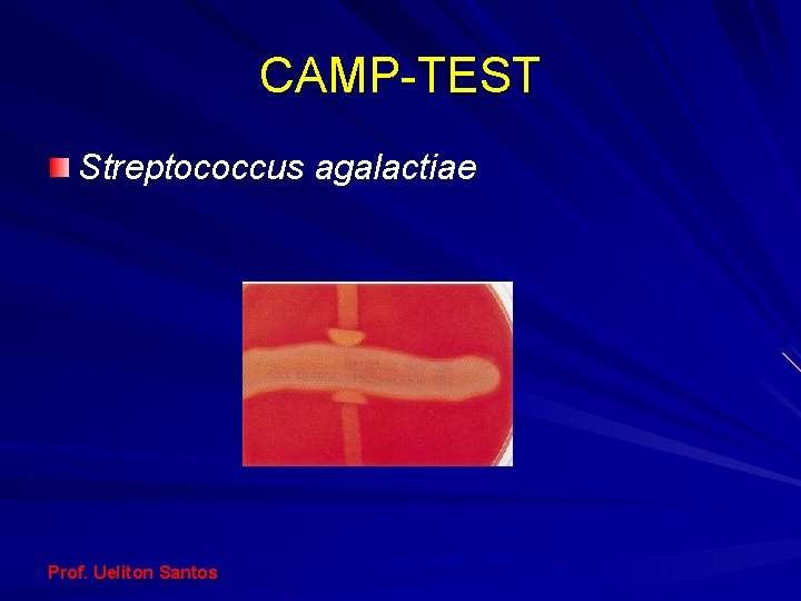 CAMP-TEST Streptococcus agalactiae Prof. Ueliton Santos 