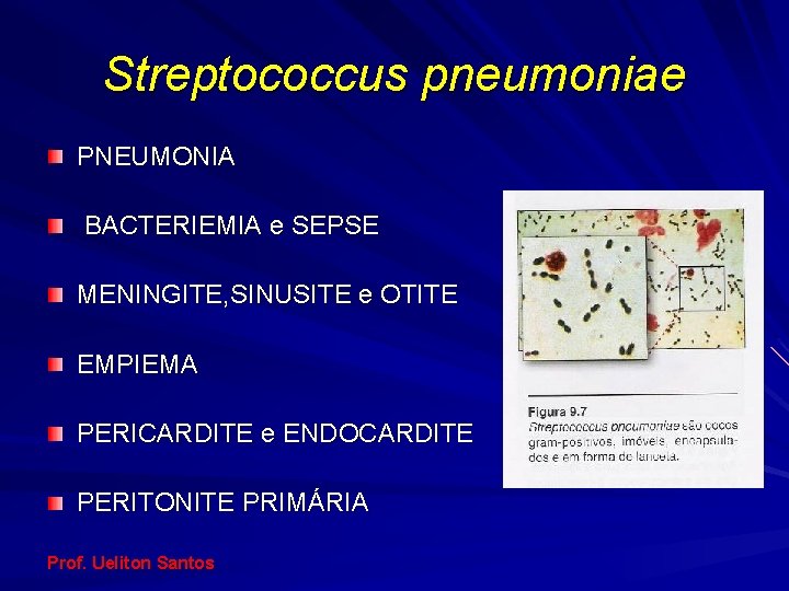 Streptococcus pneumoniae PNEUMONIA BACTERIEMIA e SEPSE MENINGITE, SINUSITE e OTITE EMPIEMA PERICARDITE e ENDOCARDITE