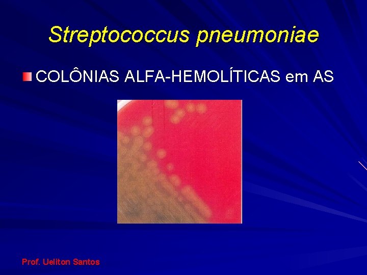 Streptococcus pneumoniae COLÔNIAS ALFA-HEMOLÍTICAS em AS Prof. Ueliton Santos 