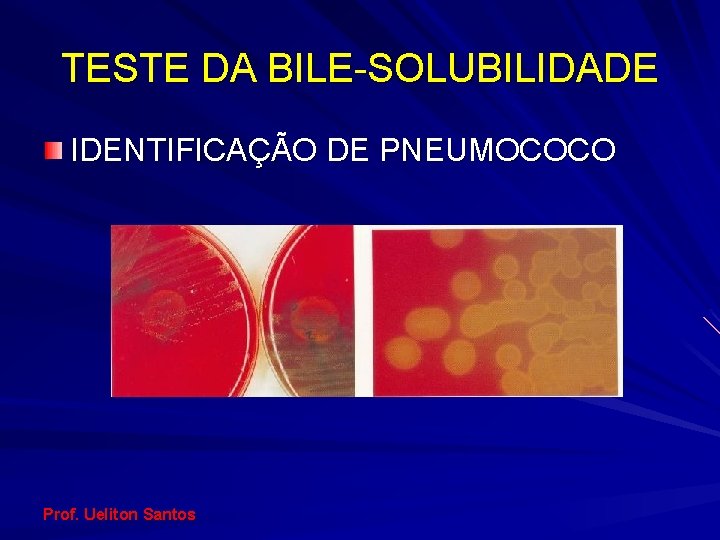 TESTE DA BILE-SOLUBILIDADE IDENTIFICAÇÃO DE PNEUMOCOCO Prof. Ueliton Santos 