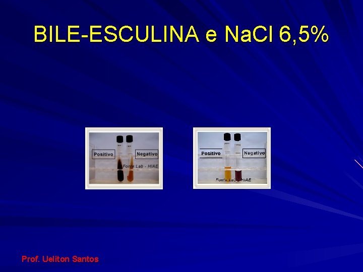 BILE-ESCULINA e Na. Cl 6, 5% Prof. Ueliton Santos 