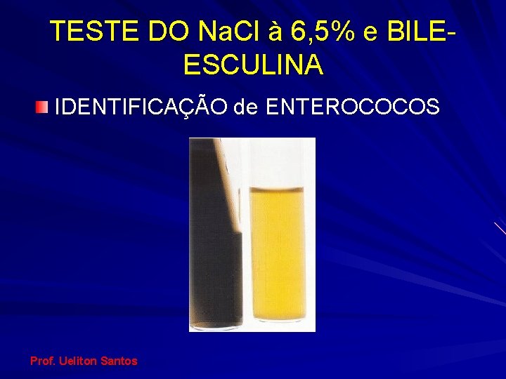 TESTE DO Na. Cl à 6, 5% e BILEESCULINA IDENTIFICAÇÃO de ENTEROCOCOS Prof. Ueliton