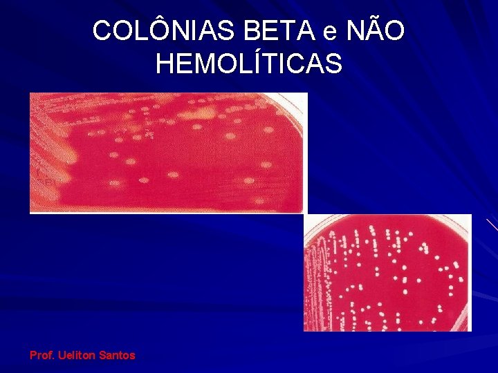 COLÔNIAS BETA e NÃO HEMOLÍTICAS Prof. Ueliton Santos 