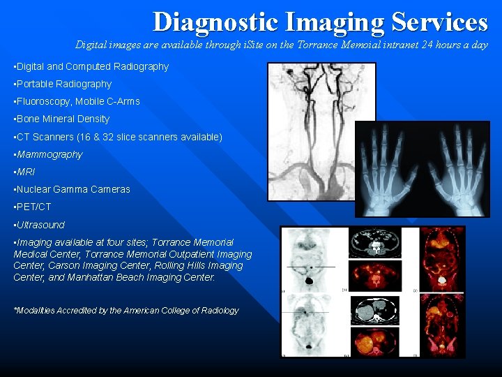 Diagnostic Imaging Services Digital images are available through i. Site on the Torrance Memoial