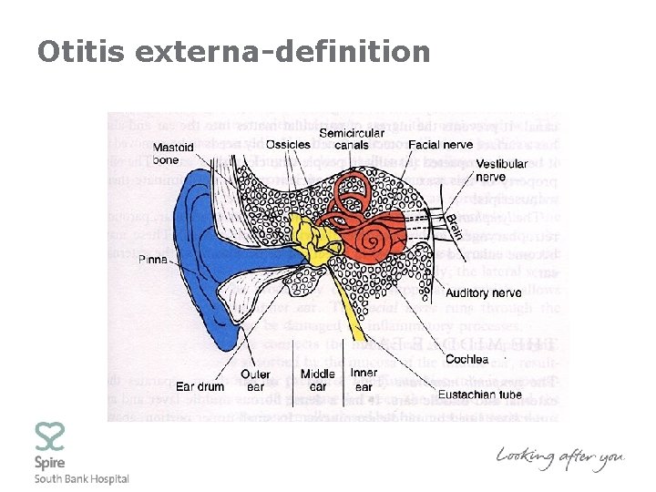 Otitis externa-definition 