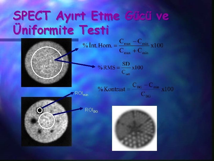 SPECT Ayırt Etme Gücü ve Üniformite Testi ROImin ROIBG 