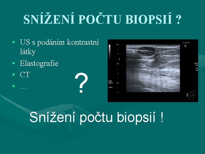 SNÍŽENÍ POČTU BIOPSIÍ ? • US s podáním kontrastní látky • Elastografie • CT