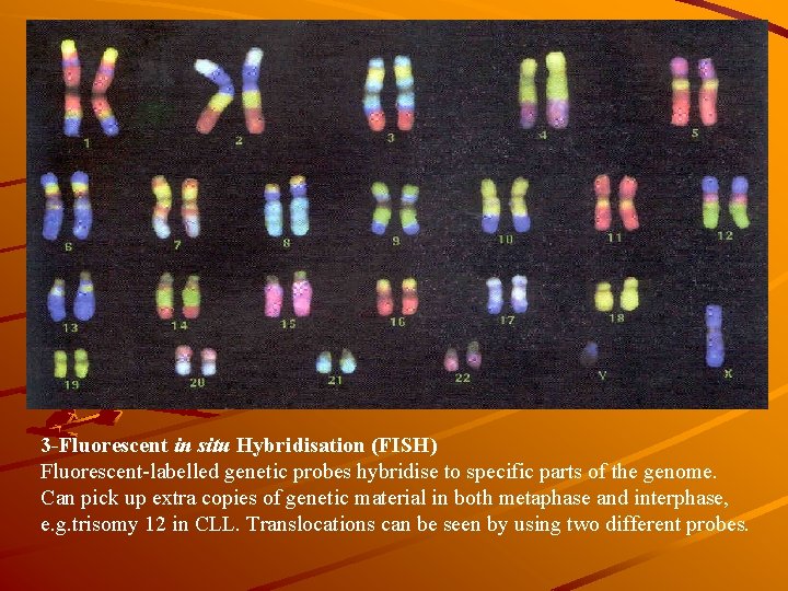 3 -Fluorescent in situ Hybridisation (FISH) Fluorescent-labelled genetic probes hybridise to specific parts of