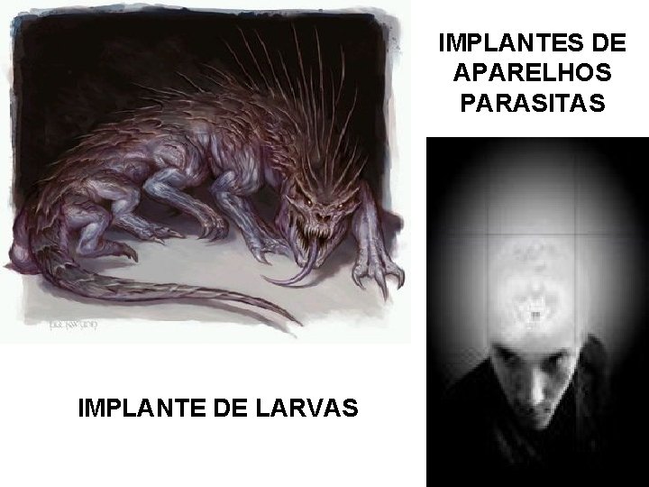 IMPLANTES DE APARELHOS PARASITAS IMPLANTE DE LARVAS 