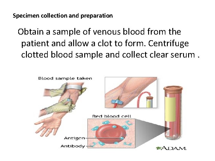 Antigen Antibody interaction Principles and applications