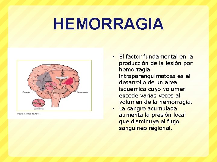 HEMORRAGIA • El factor fundamental en la producción de la lesión por hemorragia intraparenquimatosa