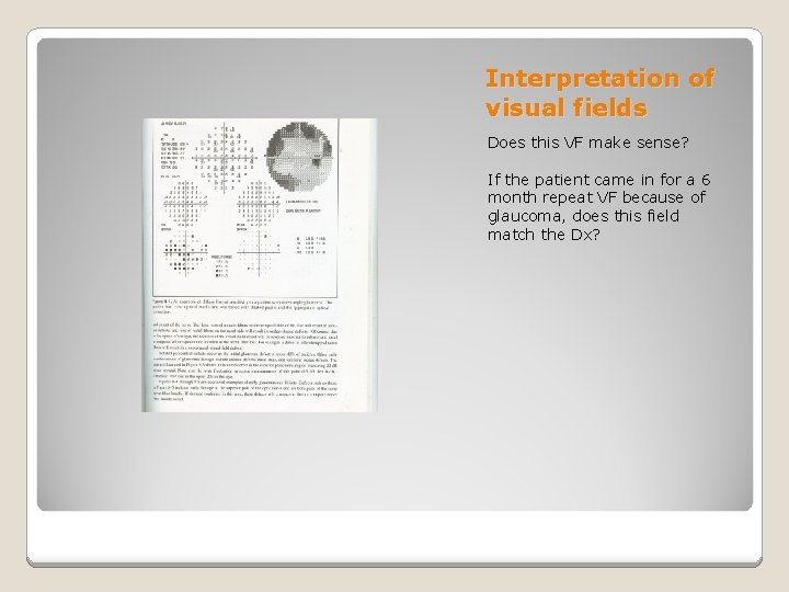 Interpretation of visual fields Does this VF make sense? If the patient came in