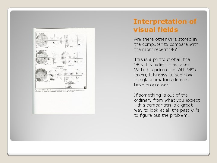 Interpretation of visual fields Are there other VF’s stored in the computer to compare