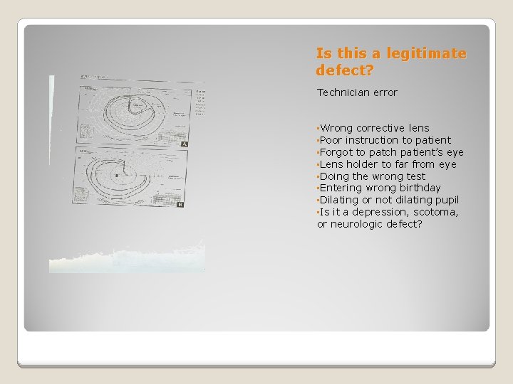 Is this a legitimate defect? Technician error • Wrong corrective lens • Poor instruction