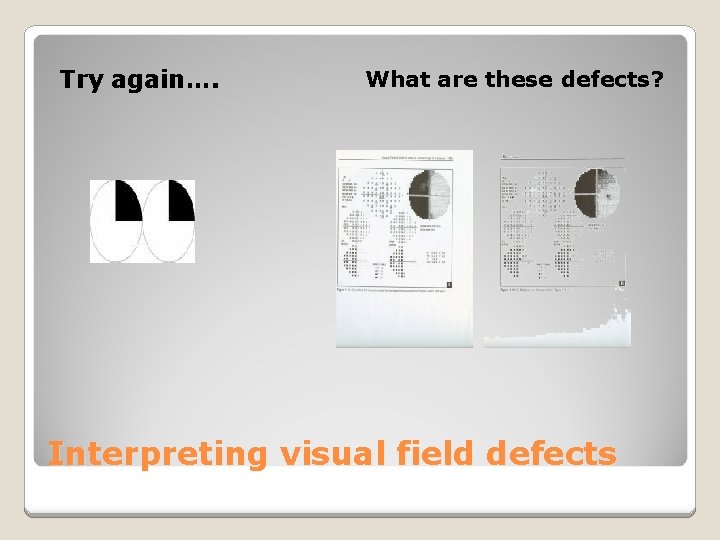 Try again…. What are these defects? Interpreting visual field defects 