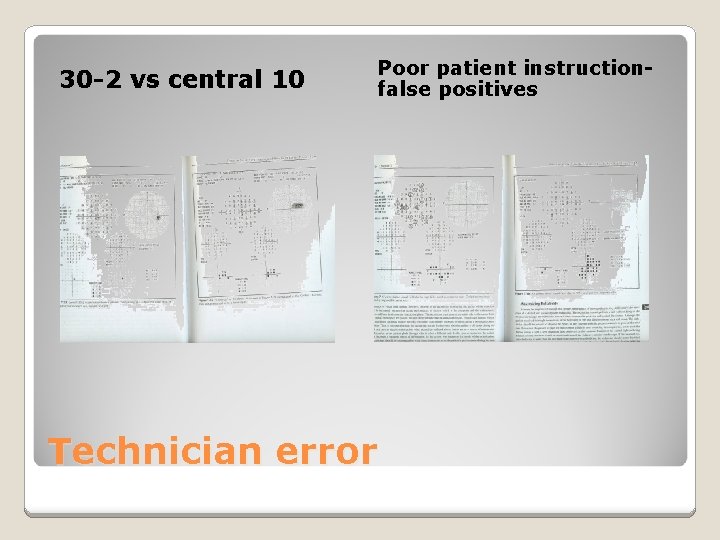 30 -2 vs central 10 Poor patient instructionfalse positives Technician error 