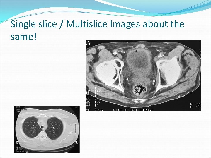 Single slice / Multislice Images about the same! 