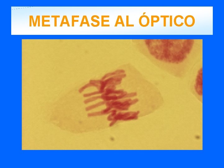 METAFASE AL ÓPTICO 