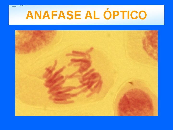 ANAFASE AL ÓPTICO 