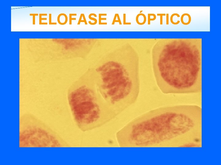 TELOFASE AL ÓPTICO 