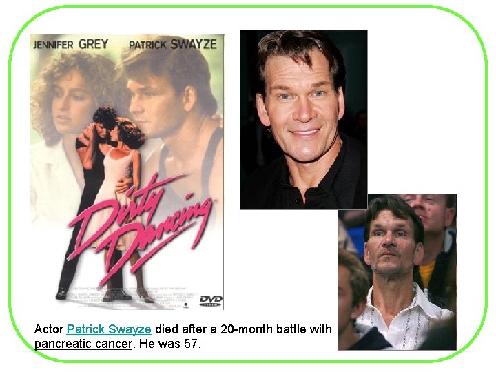 Actor Patrick Swayze died after a 20 -month battle with pancreatic cancer. He was