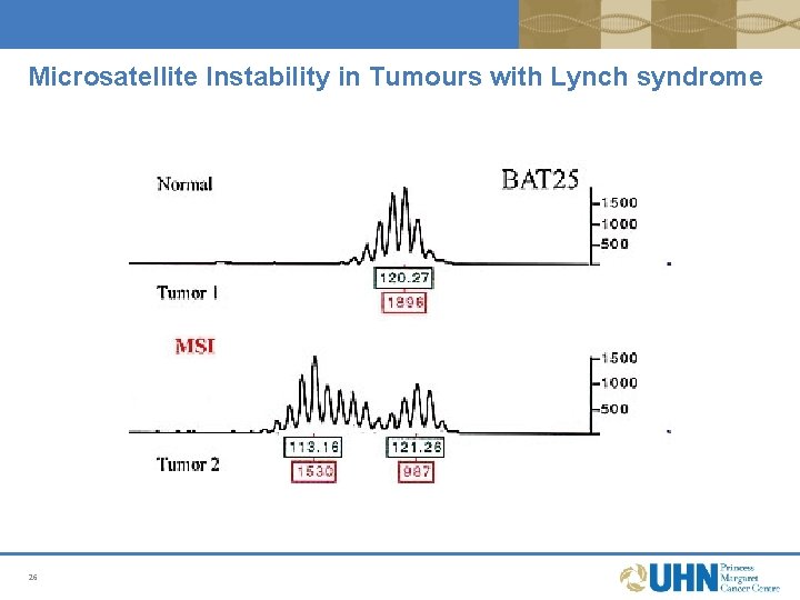 Microsatellite Instability in Tumours with Lynch syndrome 26 Microsatellite Instability in Tumours with Lynch syndrome 26