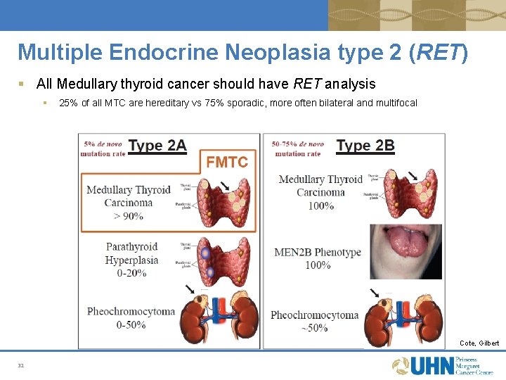 Multiple Endocrine Neoplasia type 2 (RET) § All Medullary thyroid cancer should have RET Multiple Endocrine Neoplasia type 2 (RET) § All Medullary thyroid cancer should have RET