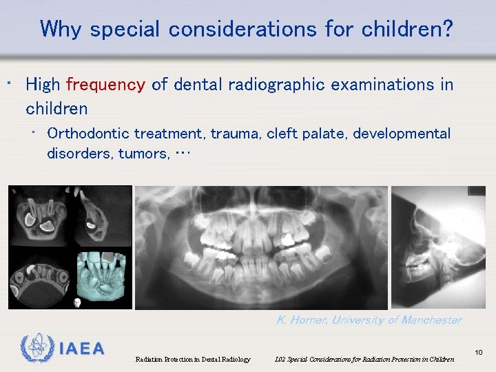 Why special considerations for children? • High frequency of dental radiographic examinations in children