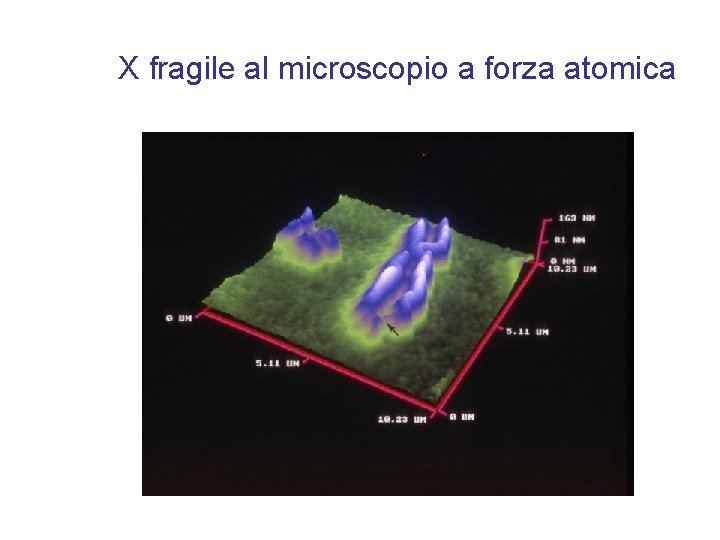 X fragile al microscopio a forza atomica 