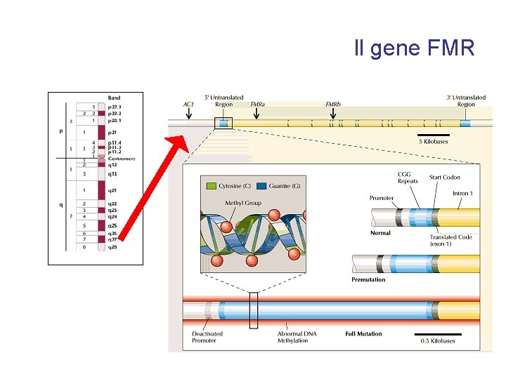 Il gene FMR 