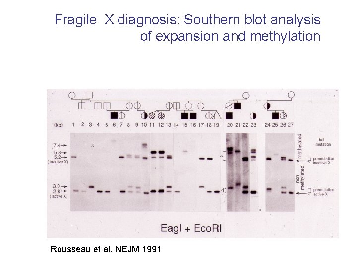 Fragile X diagnosis: Southern blot analysis of expansion and methylation Rousseau et al. NEJM Fragile X diagnosis: Southern blot analysis of expansion and methylation Rousseau et al. NEJM