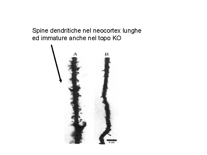 Spine dendritiche nel neocortex lunghe ed immature anche nel topo KO 