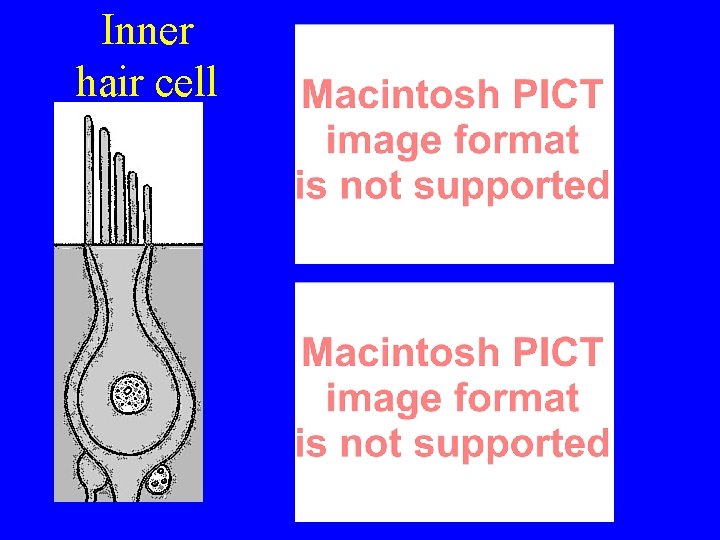 Inner hair cell Inner hair cell