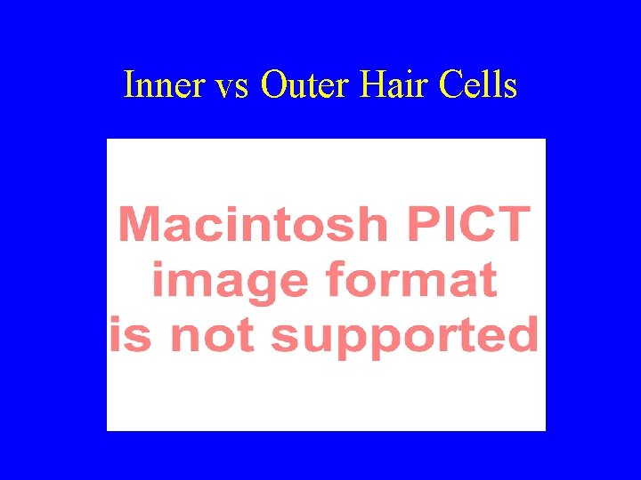 Inner vs Outer Hair Cells 