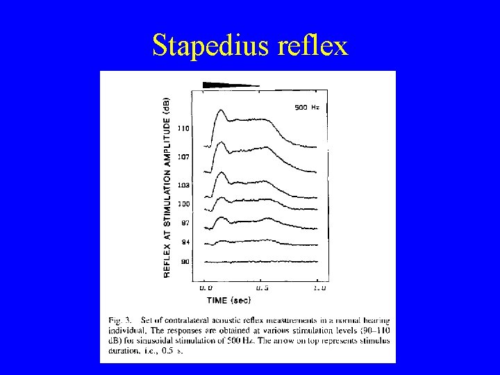 Stapedius reflex Stapedius reflex