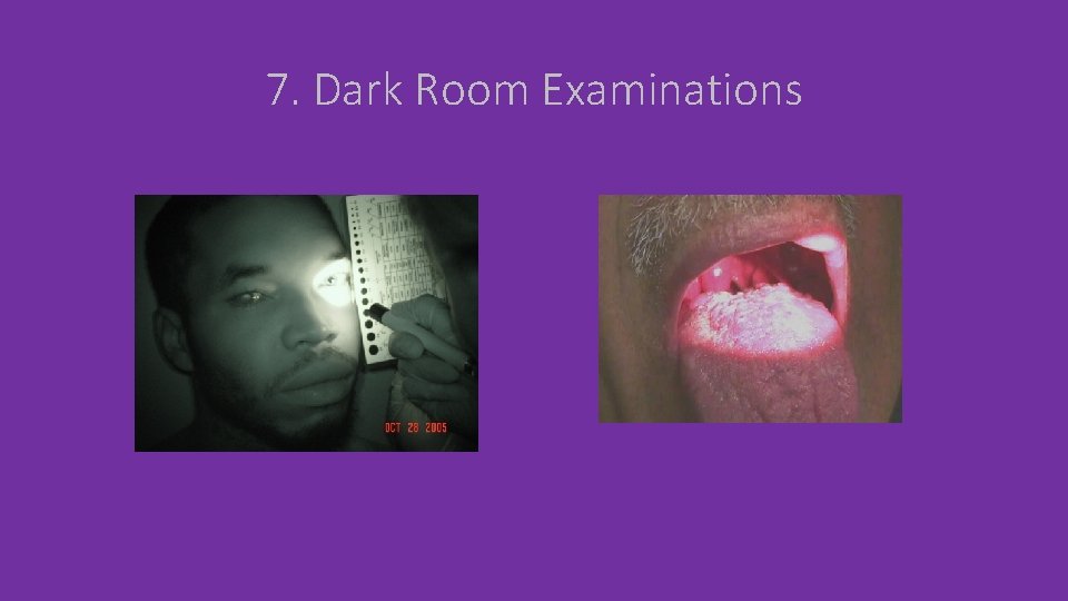 7. Dark Room Examinations 