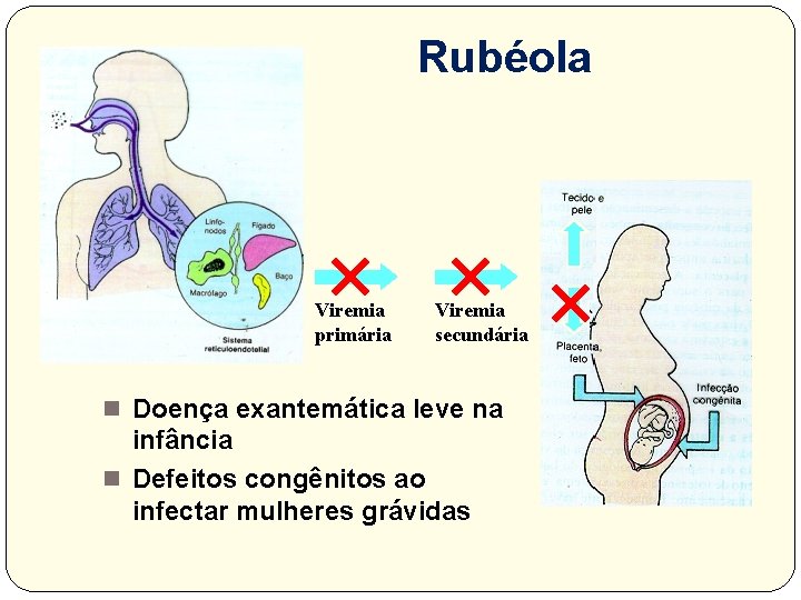 Rubéola Viremia primária Viremia secundária n Doença exantemática leve na infância n Defeitos congênitos