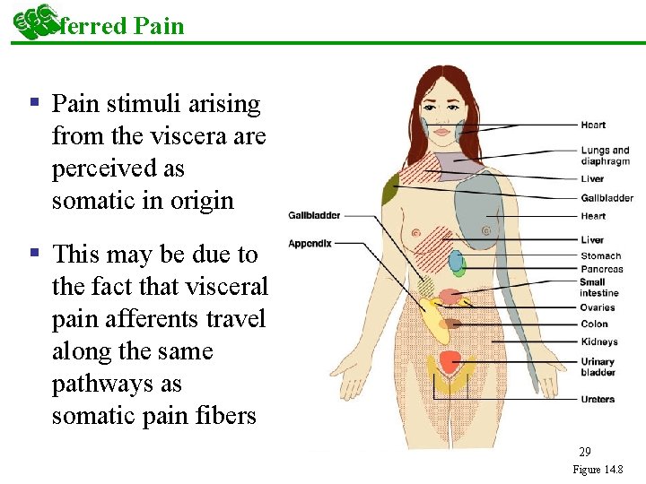 Referred Pain § Pain stimuli arising from the viscera are perceived as somatic in